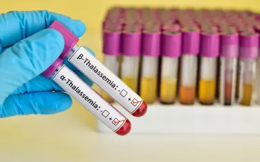 Hình ảnh chi tiết tin tức Mang gen bệnh thalassemia vẫn có thể sinh con khoẻ mạnh Hình ảnh tin tức Mang gen bệnh thalassemia vẫn có thể sinh con khoẻ mạnh